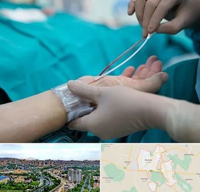 آنژیوگرافی در شهریار