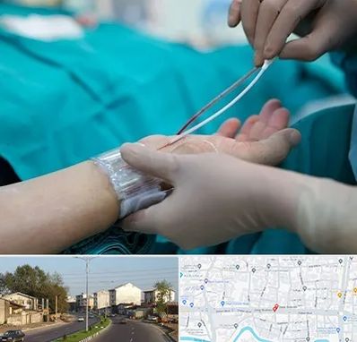 آنژیوگرافی در ضیابری رشت