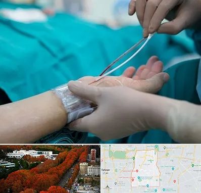 آنژیوگرافی در منطقه 6 تهران