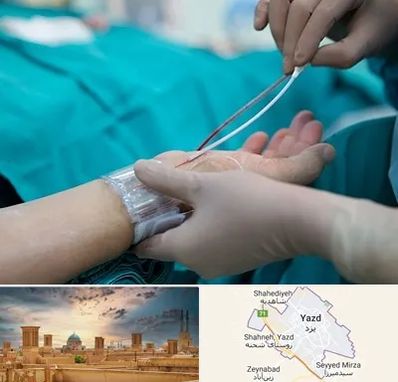 آنژیوگرافی در یزد