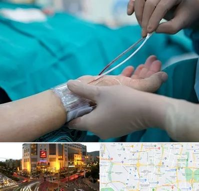 آنژیوگرافی در جنت آباد تهران 