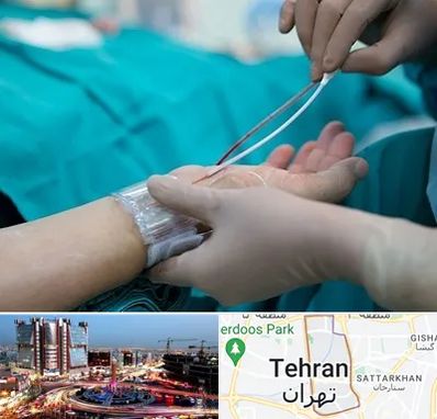 آنژیوگرافی در صادقیه 