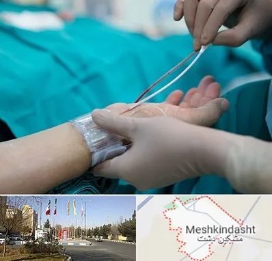 آنژیوگرافی در مشکین دشت