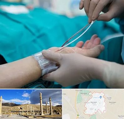 آنژیوگرافی در مرودشت