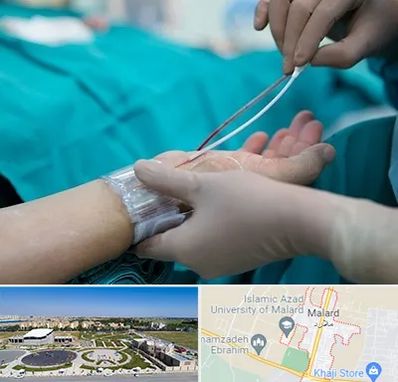 آنژیوگرافی در ملارد