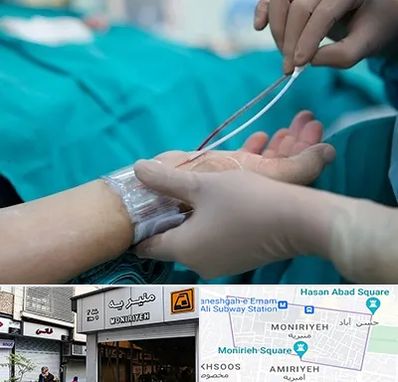 آنژیوگرافی در منیریه 