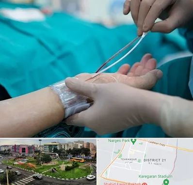 آنژیوگرافی در تهرانسر 