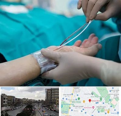 آنژیوگرافی در بلوار فردوسی مشهد