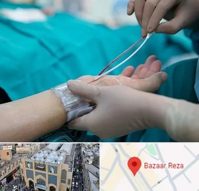 آنژیوگرافی در بازار رضا مشهد