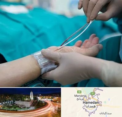 آنژیوگرافی در همدان