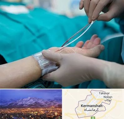 آنژیوگرافی در کرمانشاه