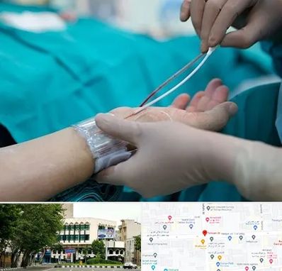 آنژیوگرافی در طالقانی