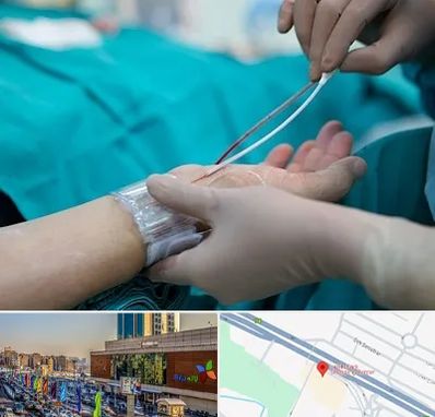 آنژیوگرافی در لاله پارک تبریز