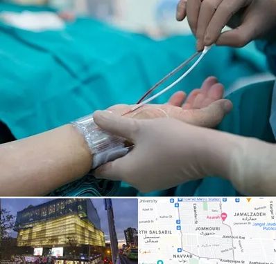 آنژیوگرافی در جمهوری 