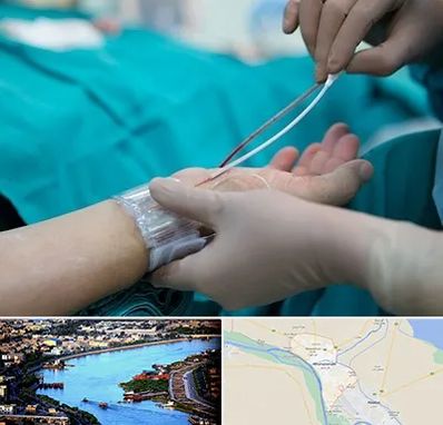 آنژیوگرافی در خرمشهر
