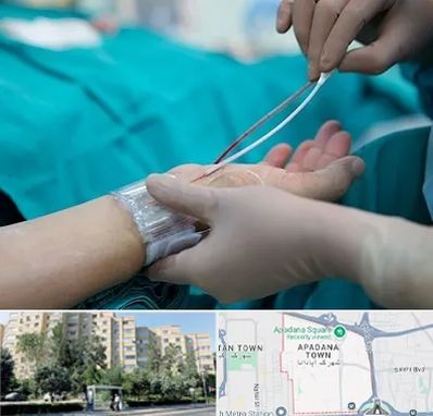 آنژیوگرافی در آپادانا