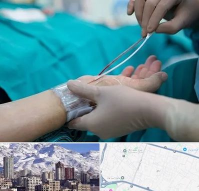 آنژیوگرافی در ازگل