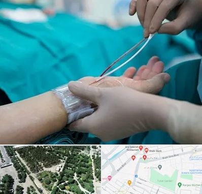 آنژیوگرافی در سالاریه قم