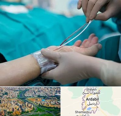 آنژیوگرافی در اردبیل