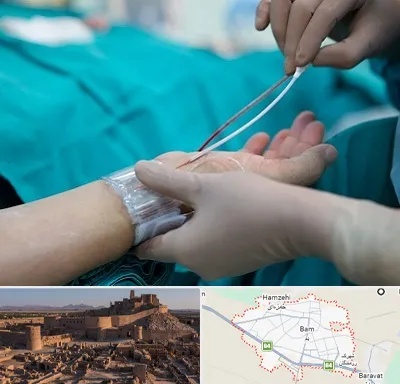 آنژیوگرافی در بم