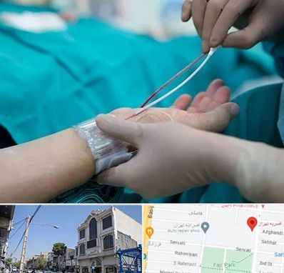 آنژیوگرافی در افسریه 