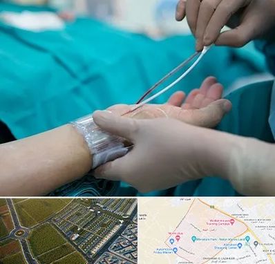 آنژیوگرافی در الهیه مشهد