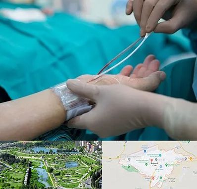 آنژیوگرافی در بجنورد