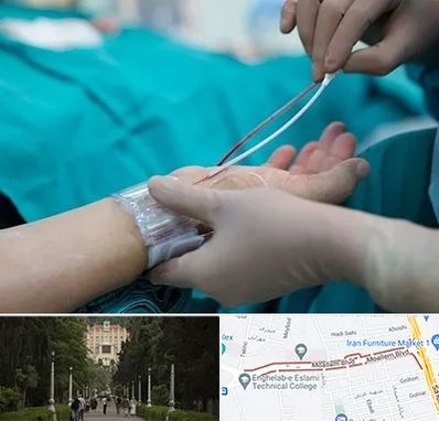 آنژیوگرافی در بلوار معلم رشت 