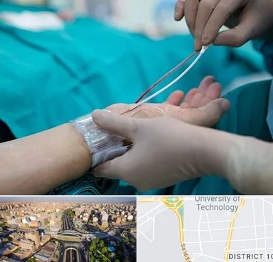 آنژیوگرافی در استاد معین 