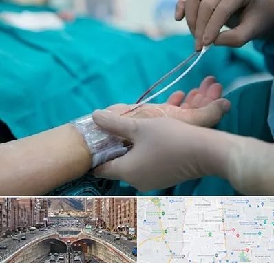 آنژیوگرافی در منطقه 10 تهران