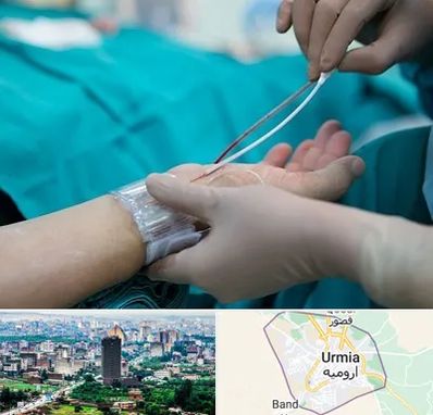 آنژیوگرافی در ارومیه