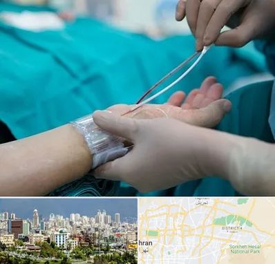 آنژیوگرافی در شرق تهران 