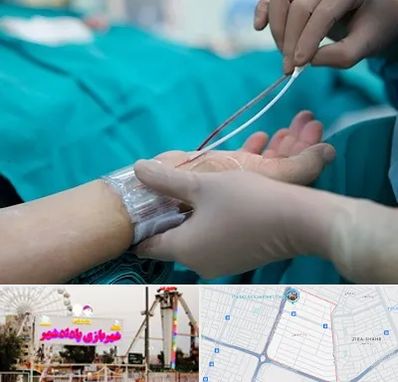 آنژیوگرافی در پادادشهر اهواز