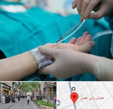 آنژیوگرافی در ولیعصر شهریار
