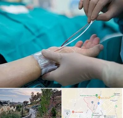 آنژیوگرافی در باغستان کرج