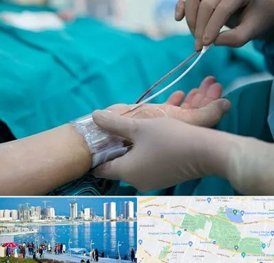 آنژیوگرافی در چیتگر 