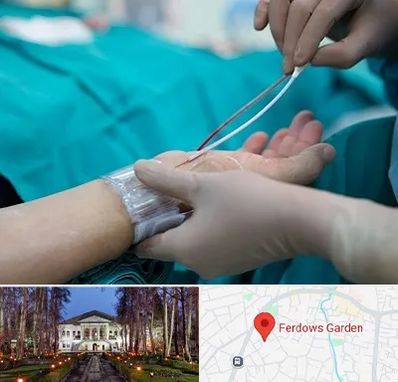 آنژیوگرافی در باغ فردوس