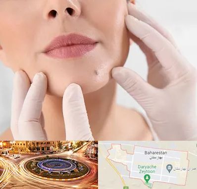 برداشتن خال در بهارستان