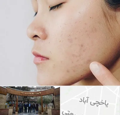 دکتر جوش صورت در یاخچی آباد