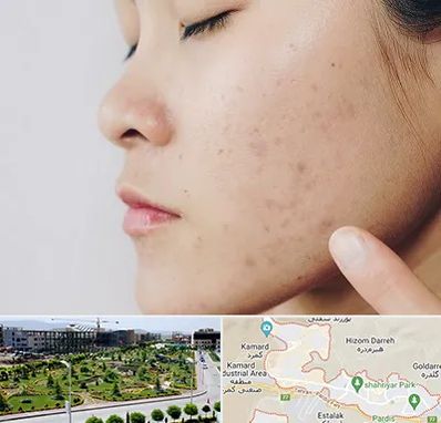 دکتر جوش صورت در پردیس