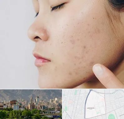 دکتر جوش صورت در جمشیدیه