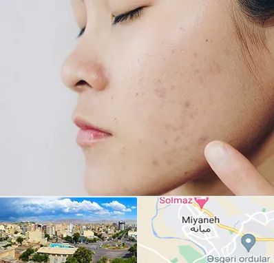 دکتر جوش صورت در میانه