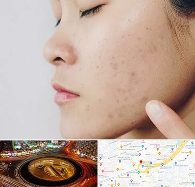 دکتر جوش صورت در میدان ولیعصر