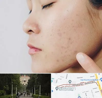 دکتر جوش صورت در بلوار معلم رشت 