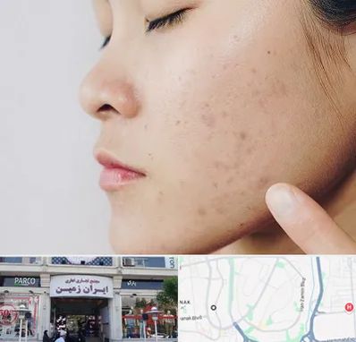 دکتر جوش صورت در ایران زمین