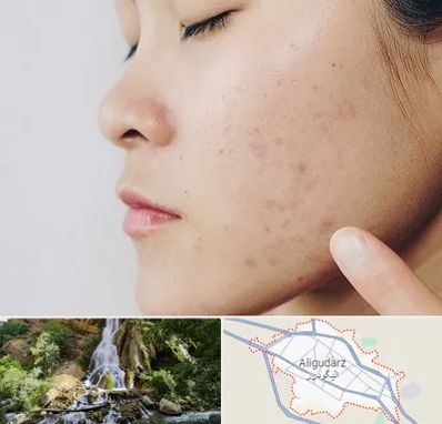 دکتر جوش صورت در الیگودرز