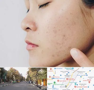 دکتر جوش صورت در شریعتی 