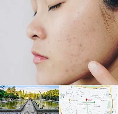 دکتر جوش صورت در سرسبز