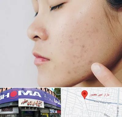 دکتر جوش صورت در امین حضور