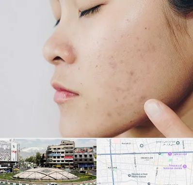 دکتر جوش صورت در مرکز تهران